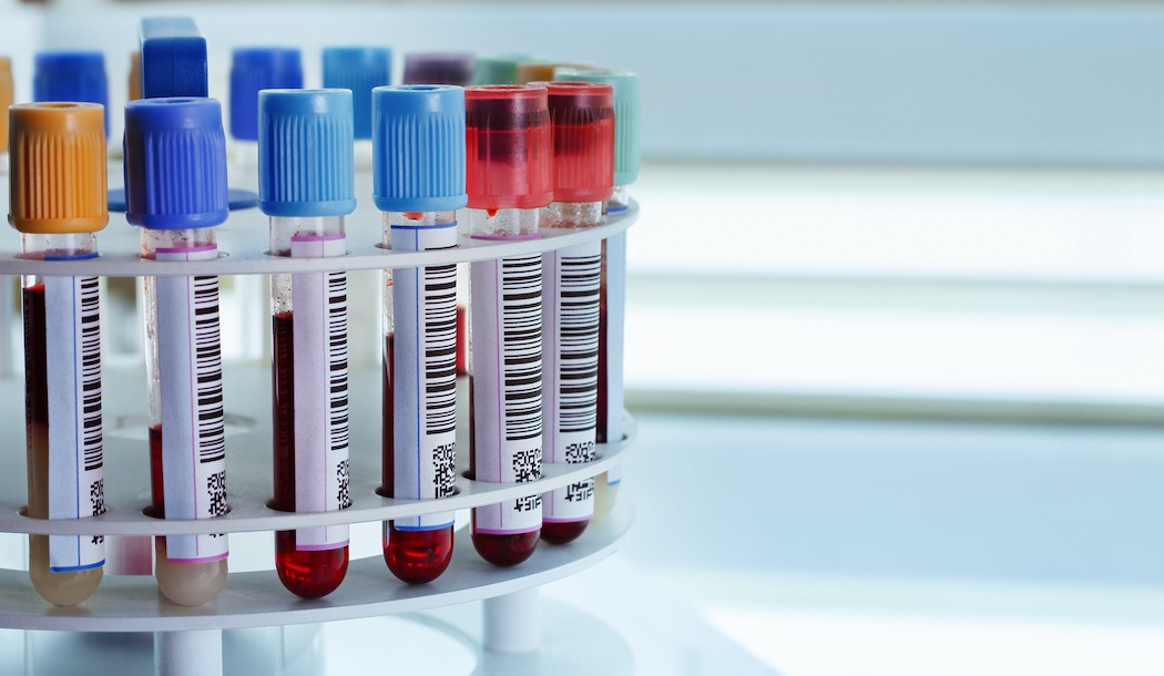 Cancer Defeated | Turn Your Blood into an Anti-Cancer Elixir